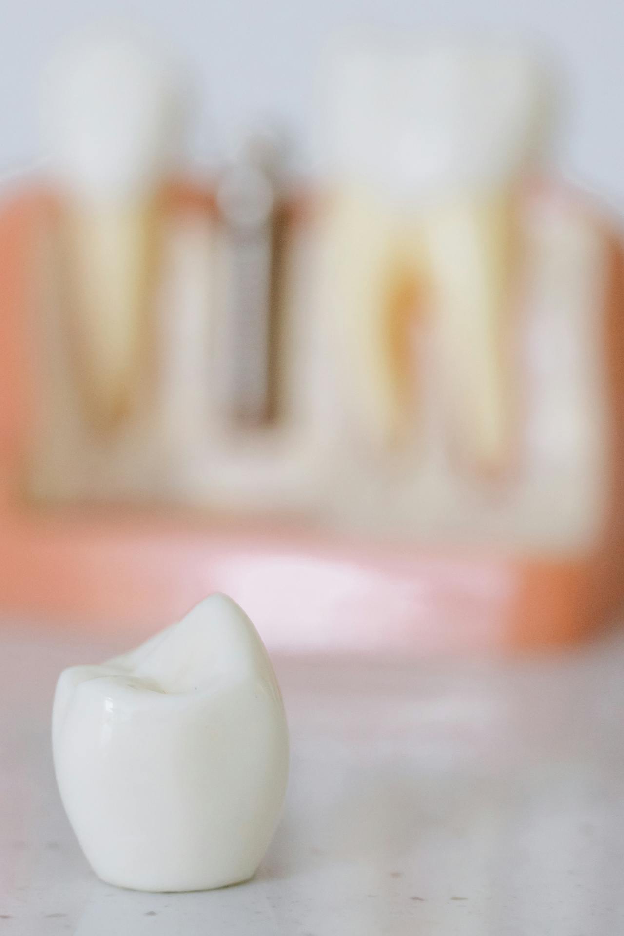 Benefits of Choosing A Local Dental Implant Clinic.